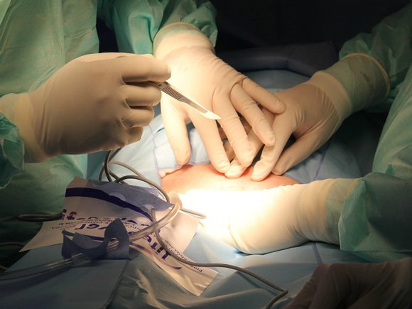 В больнице РЖД женщине по ошибке удалили грудь