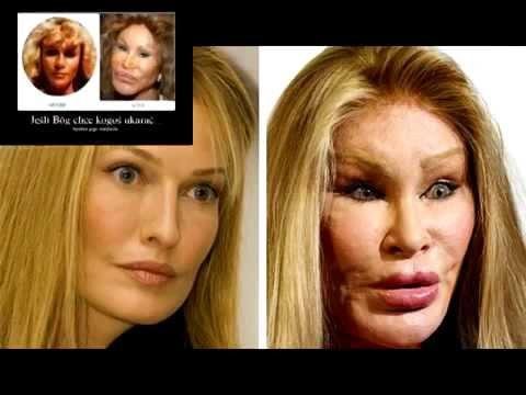 Картинки по запросу неудачные пластики звезд