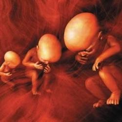 Люди с самыми шокирующими физическими аномалиями