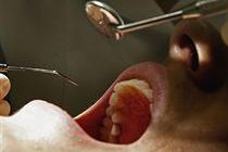 Самозванец проработал зубным врачом 29 лет