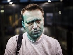 Навальный недоволен, что нападение на него расследуется как побои: видео