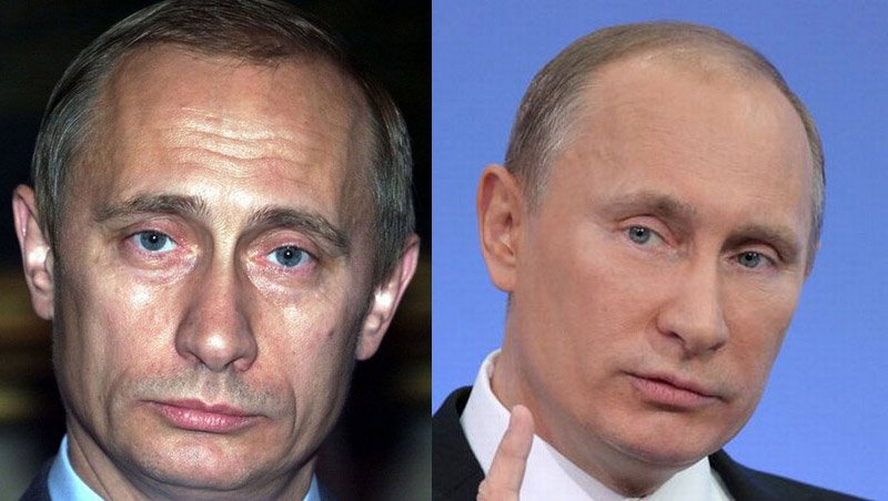 Изменения внешности Путина — пластические хирурги дали объяснения