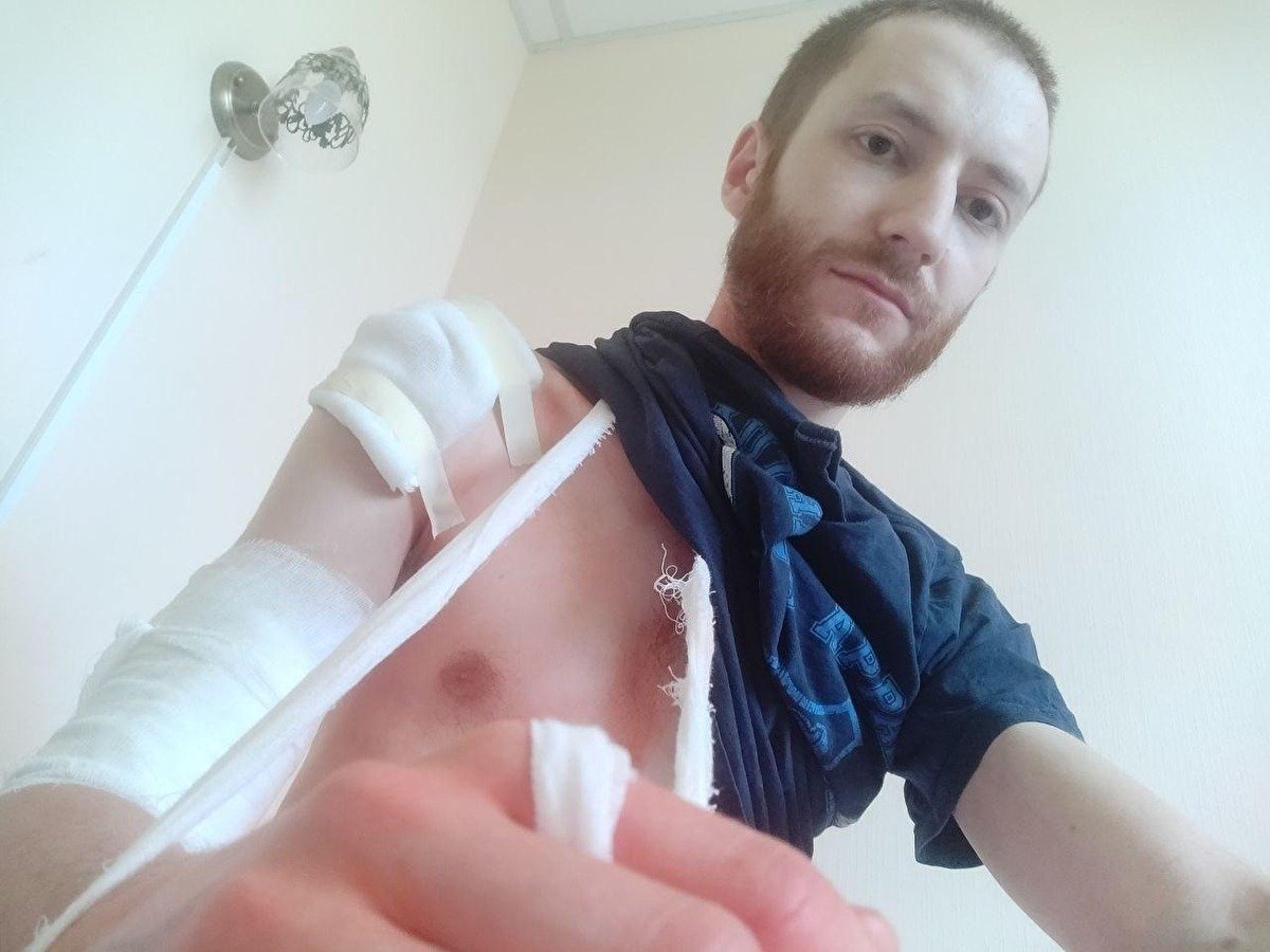 Журналист, избитый полицейскими на избирательном участке в Петербурге, обратился в ЕСПЧ