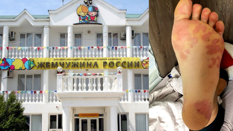 Вирус Коксаки, тучи комаров, отвратная еда: как отдыхают дети в "Жемчужине России"